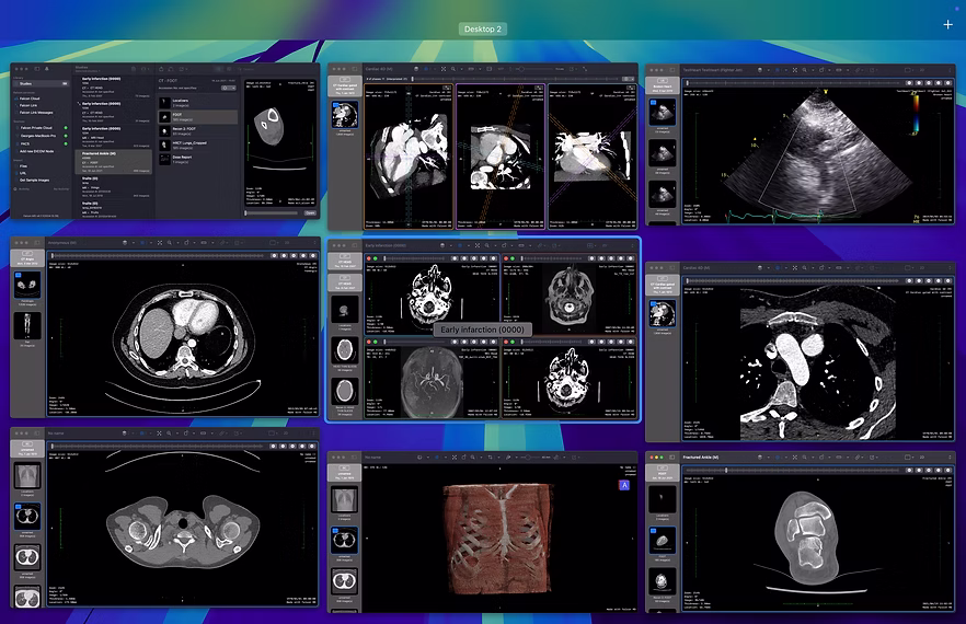 Falcon MD multi-window diagnostic workflow